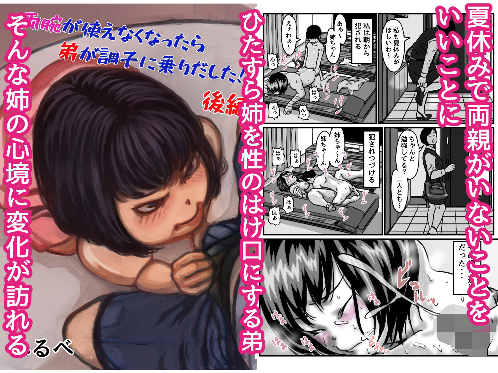 両腕が使えなくなったら弟が調子に乗りだした！ 総集編｜ふるべ